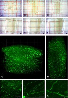 Expansion Light Sheet Microscopy Resolves Subcellular Structures in Large Portions of the Songbird Brain